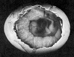 The embryo at day 10