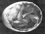 The embryo at day 16