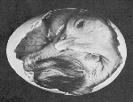 The embryo at day 18